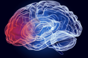 brain injury lawyers